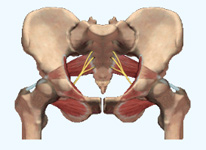 Prothese de hanche